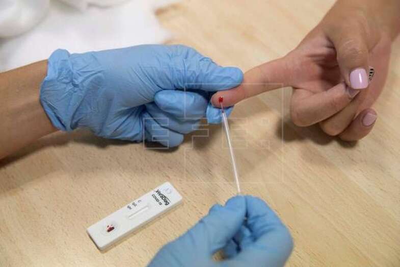 Toma de muestras de sangre para una prueba de coronavirus (Foto EFE / Marcial Guillén)